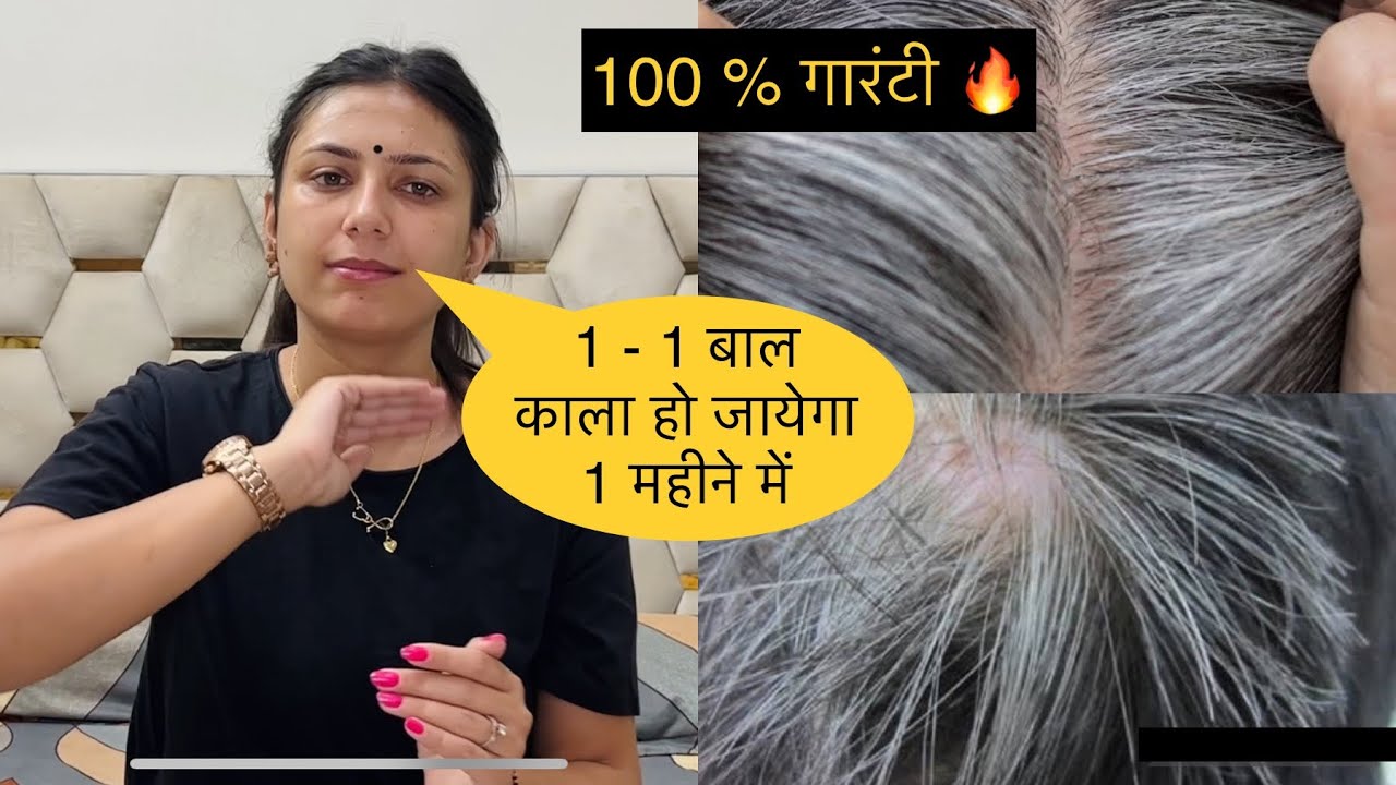 सफ़ेद बालों को घर पर काला करें | Reverse Grey Hair Naturally in 30 Days | Dr. Upasana Vohra
