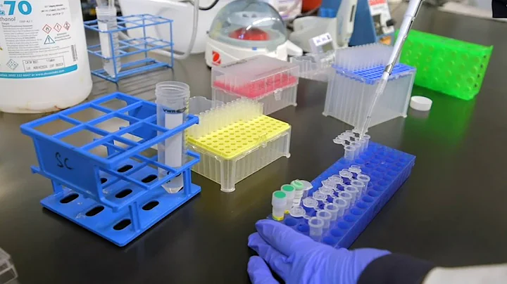 What you need to know about bird flu