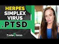 Ptsd and herpes simplex virus in va disability  all you need to know