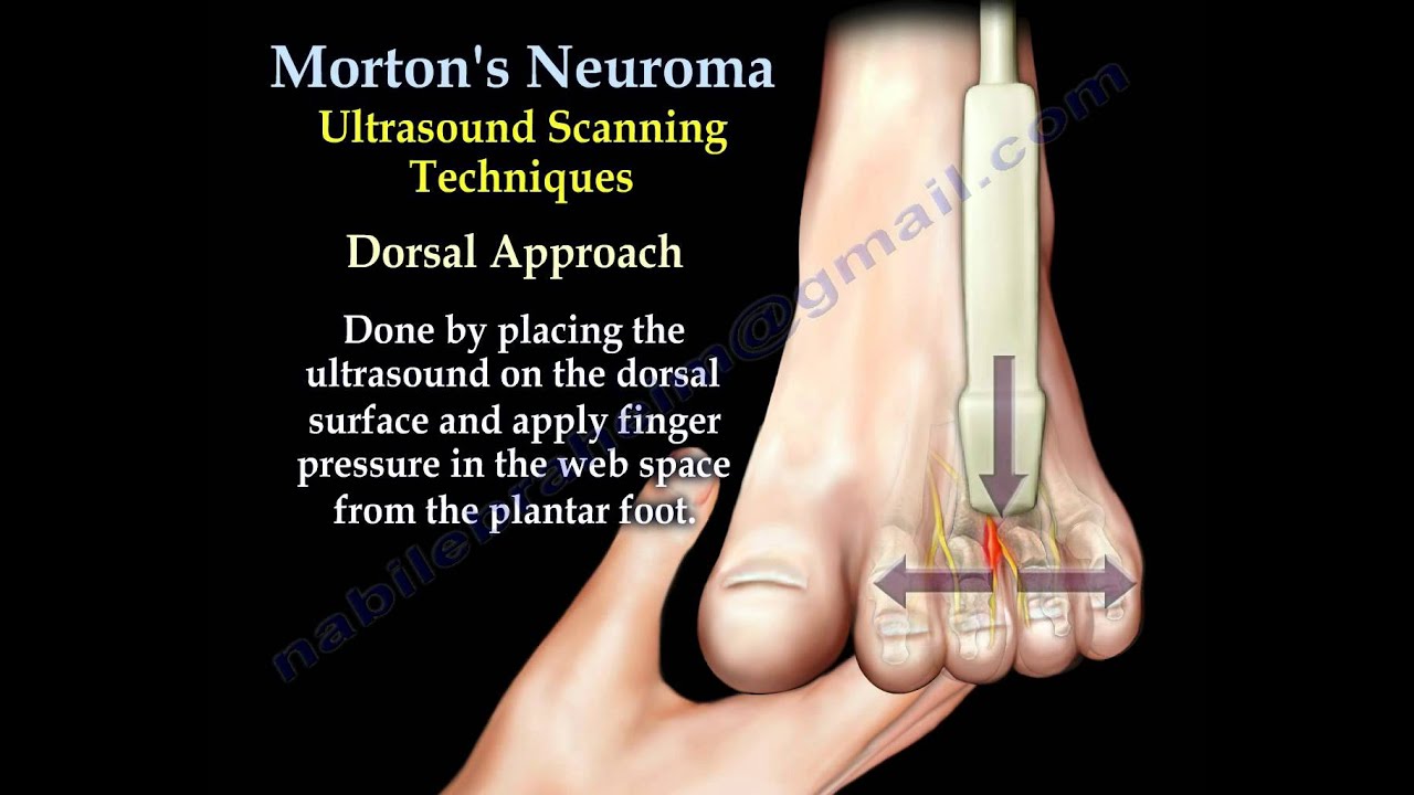 ultrasound for foot pain