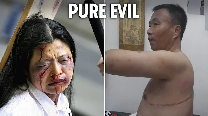 Horror of organ harvesting by China's 'Gestapo' revealed as first survivor shows injuries