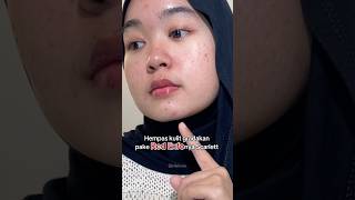 Scarlett Red Exfo🩸#scarlett #peelingserum #peelingsolution #shorts #review
