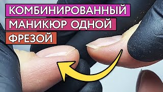 Как исправить неровные ногти? Восстановление формы ногтей после травмы