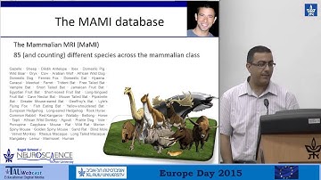 The Brain Connectome