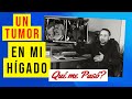 Tumor en el Higado - Que me paso??