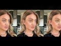 I'm Trans And Spent Over $100k 'Feminising' My Face | HOOKED ON THE LOOK