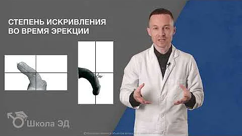 Урок 29 Диагностика болезни Пейрони
