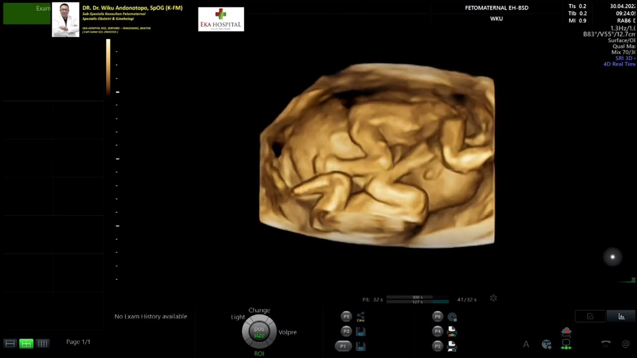Kembar Identik (Dr Wiku Andonotopo)