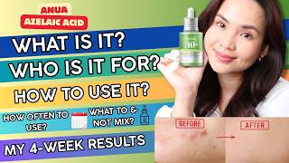 Anua Azelaic Acid ULTIMATE GUIDE + Results After 4 Weeks | ANUA Serum Tested on Acne-Prone Skin