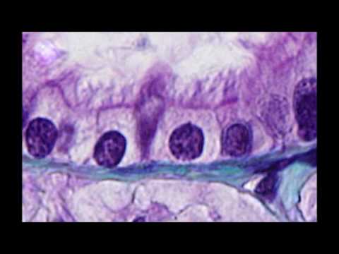 Video: ¿Los bronquiolos terminales están ciliados?