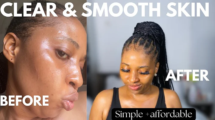 HOW TO GET CLEAR SKIN | Simple step by step routine to brighten dark marks + discolouration