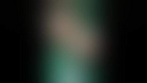 Suzuki frame for PIP joint fracture with dorsal subluxation