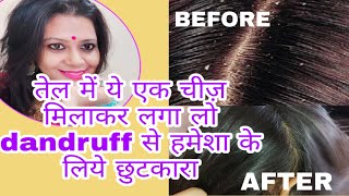 तेल में बस एक चीज़ मिलाकर लगाने से Dandruff से हमेशा के लिए छुटकारा पाएं । dandruff home remedy