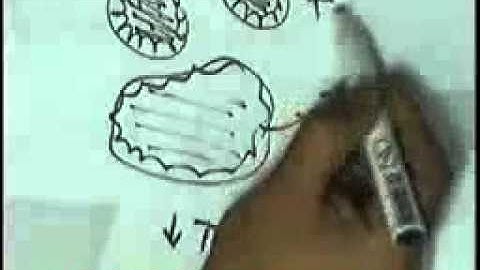 SYSTEMIC PATHOLOGY bone tumour 2 endocrine 1 DR SAMEH GHAZY