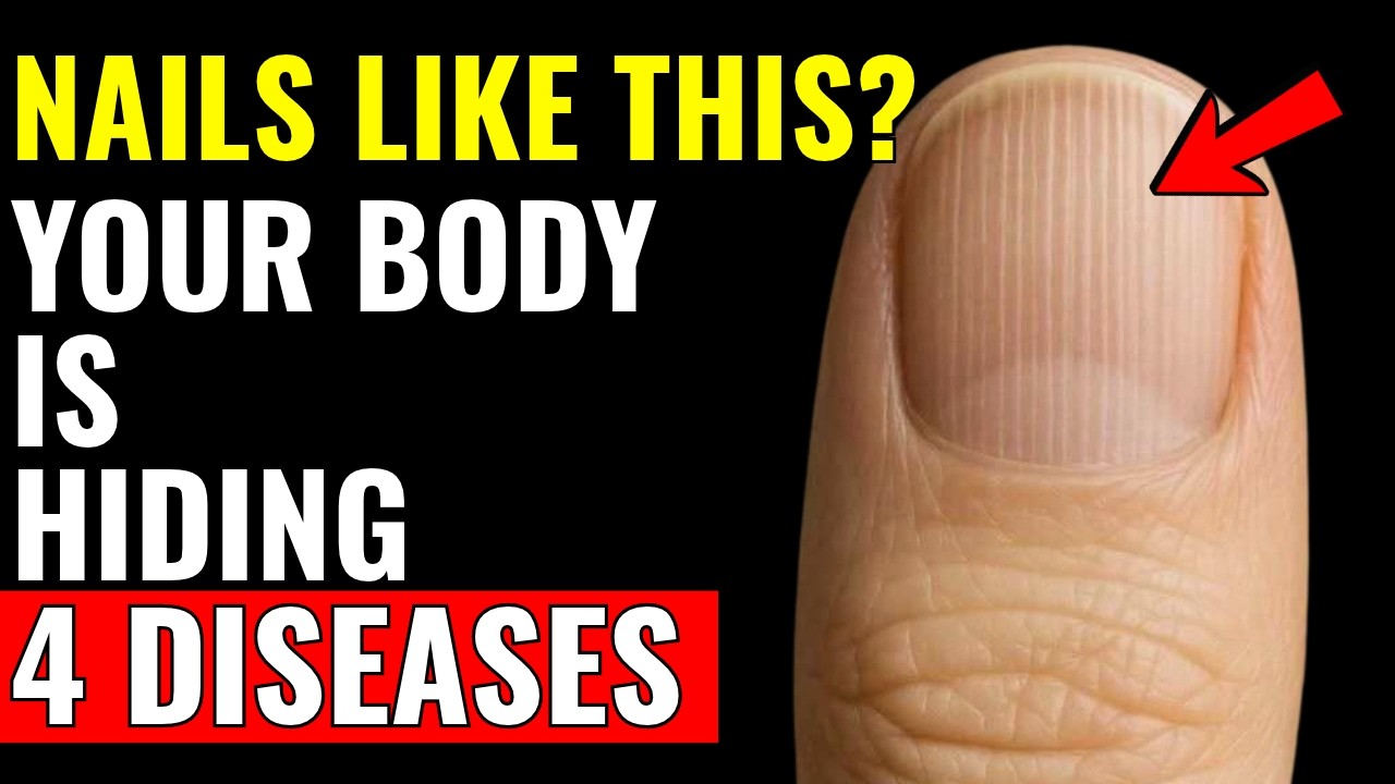 Nails Lacking If You Have These LINES on Your NAILS, Your Body Is Lacking THIS (It’s ...