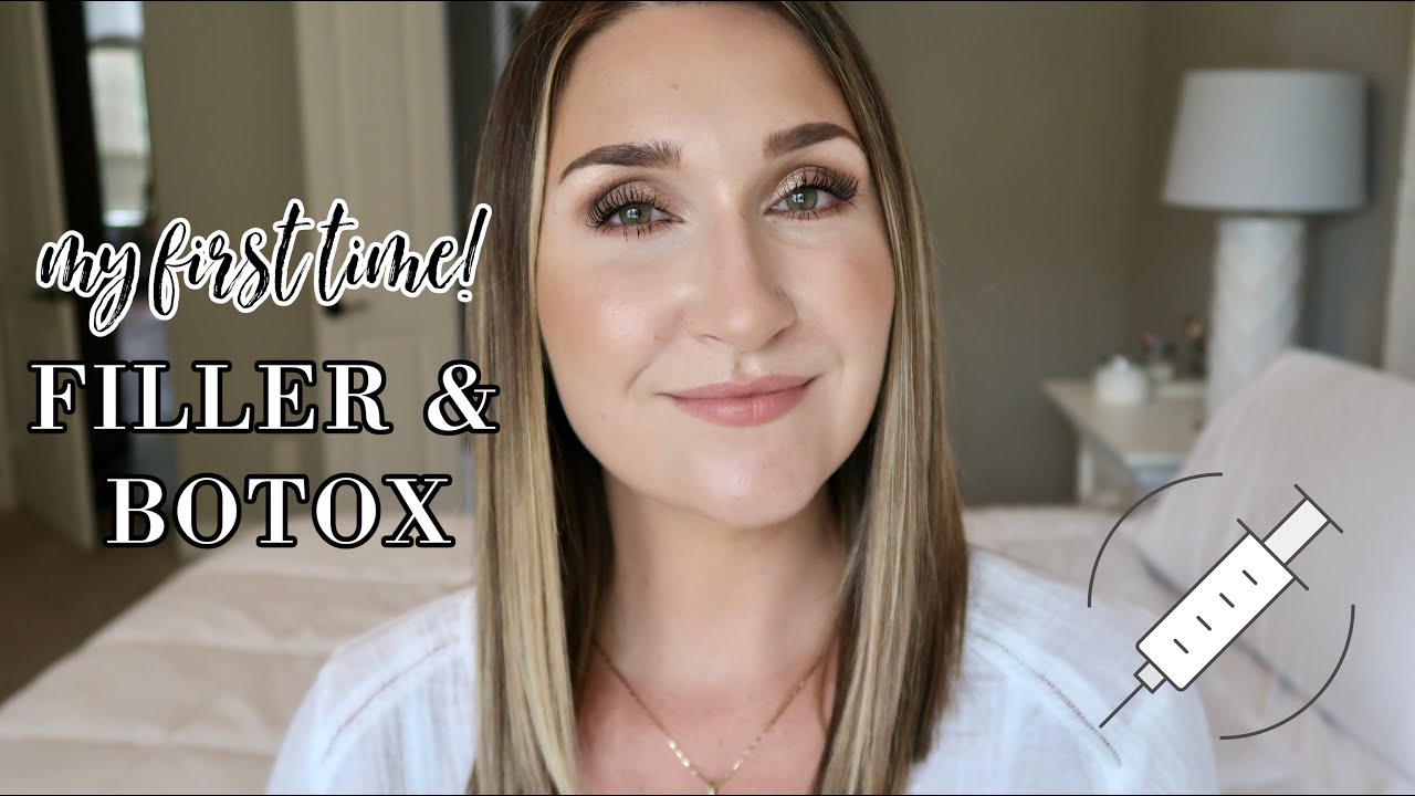 MY FILLER & BOTOX EXPERIENCE! \\ INJECTIONS, HEALING PROCESS, + BEFORE & AFTER PICS
