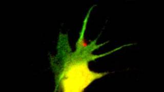 Time-lapse Imaging of Rhode-Dextran and PHakt-GFP in a Xenopus Spinal Neuron Growth Cone