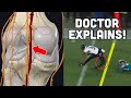 Keaton Mitchell GRAPHIC KNEE Injury | Doctor Explains!