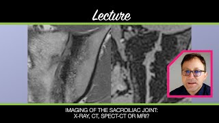 Imaging of the sacroiliac joint  Lecture by Prof. Kay G. Hermann  Xray, CT, SPECTCT and MRI