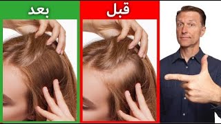 كيفية زيادة كثافة الشعر بشكل طبيعي | علاج تساقط الشعر