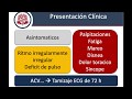 Fibrilación Auricular - Introducción y Diagnostico