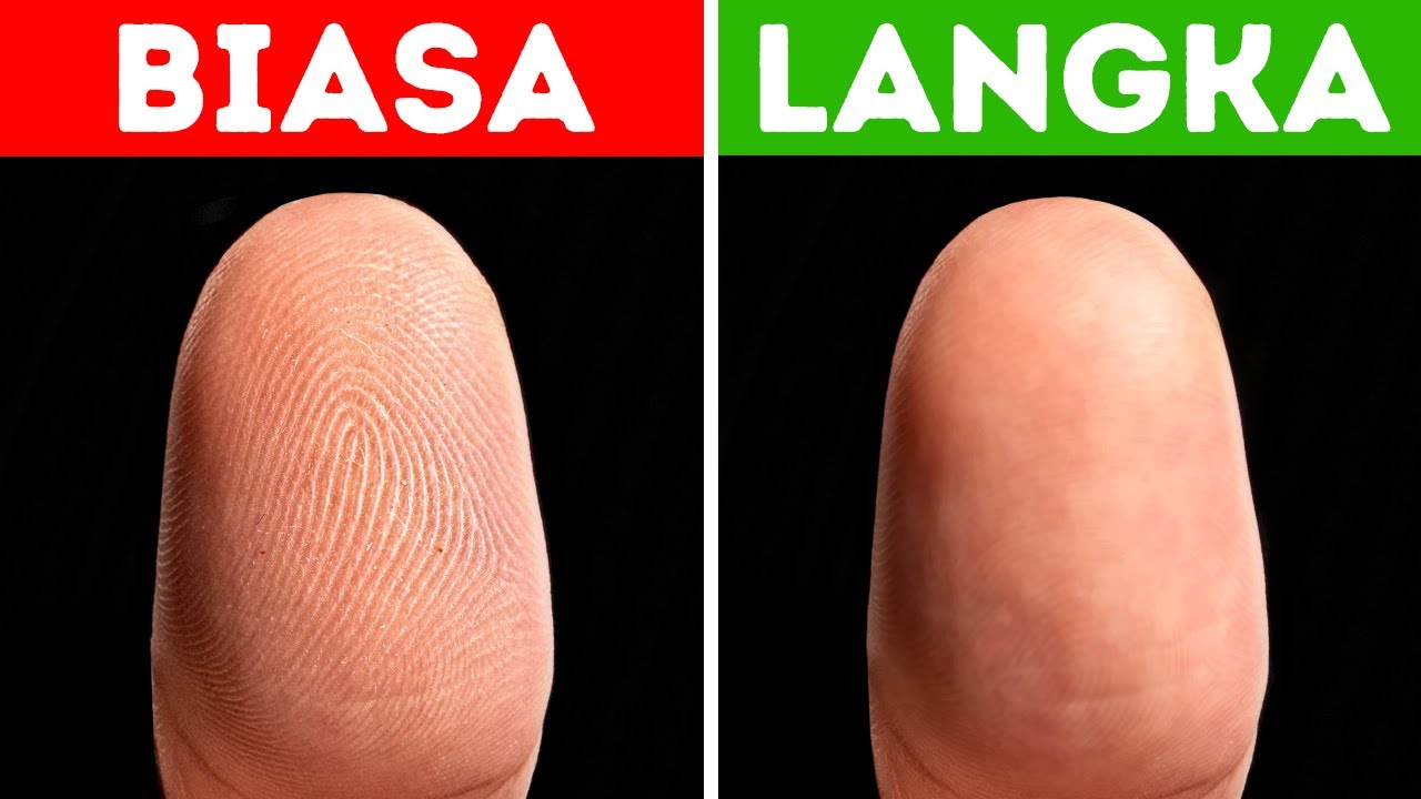 Beginilah Cara Orang yang Enggak Punya Sidik Jari Menjalani Hidup dan Bepergian