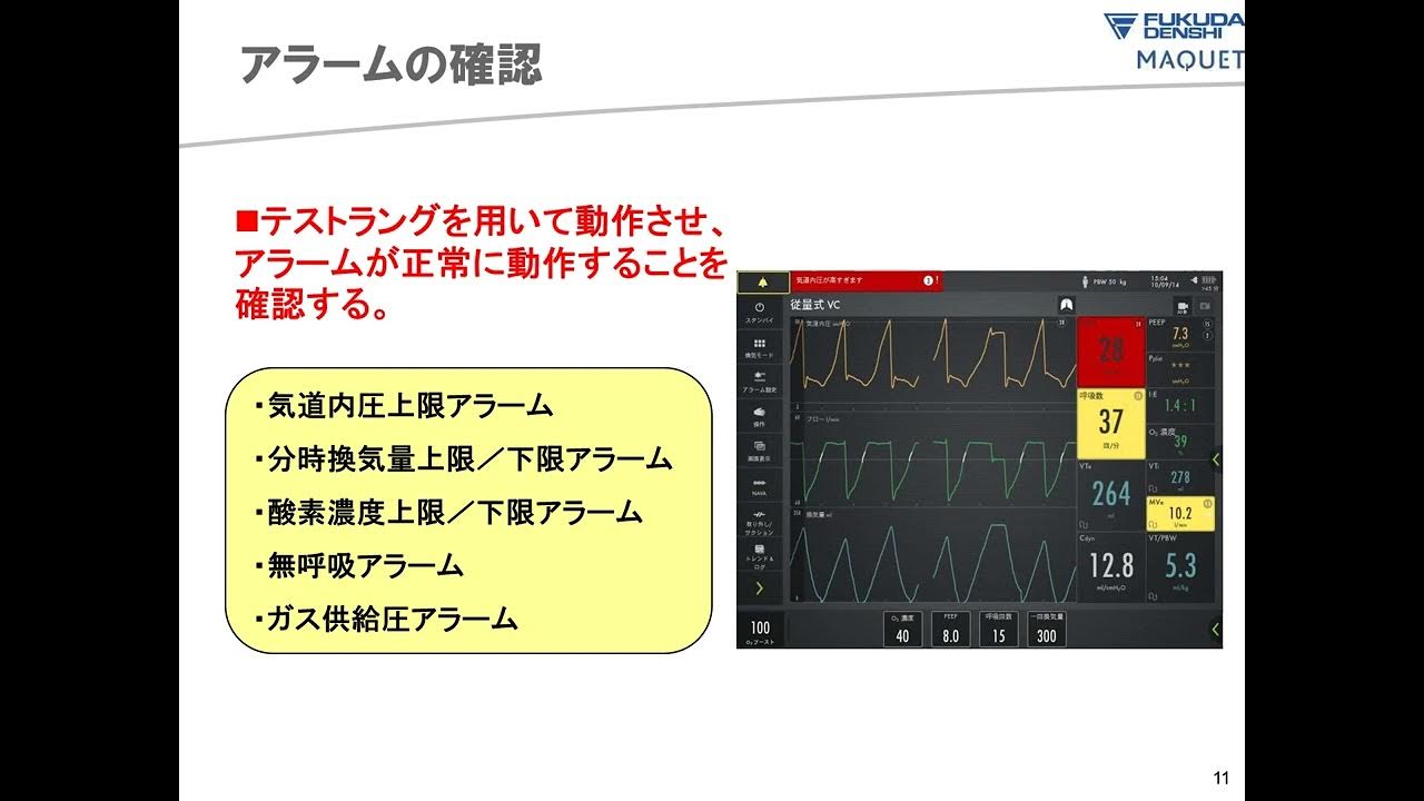 【人工呼吸器の安全管理】人工呼吸器勉強会資料 2023.1.31 YouTube 【人工呼吸器の安全管理】人工呼吸器勉強会資料 2023.1.31 YouTube