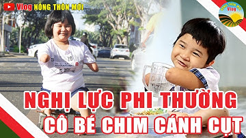 Câu chuyện nghị lực phi thường của cô bé " Chim cánh cụt " triệu trái tim rung động, khó tin có thật