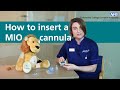 How to insert a MIO cannula