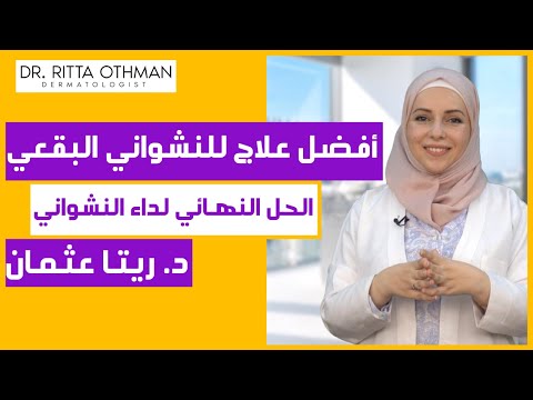 أفضل طريقة لعلاج سواد الظهر تصبغات الظهر