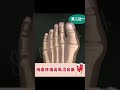 萬能類風濕止痛膏,矯正拇外翻,緩解關節腫脹,改善關節疼痛