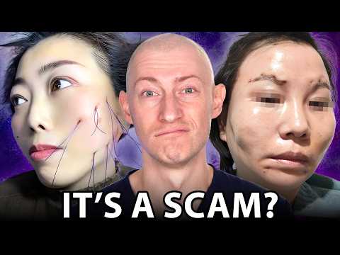 Thread Lifts Are RUINING Your Face!