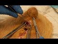 3rd and 4th Degree Perineal Laceration Repair