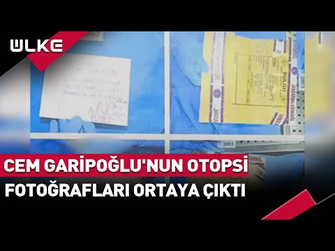 Cem Garipoğlu'nun Otopsi Fotoğrafları Ortaya Çıktı! Ölmediğine Dair İddialar Sürüyor...