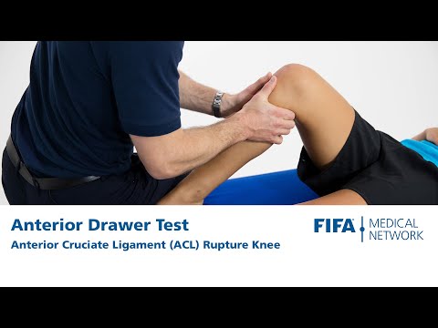 Anterior Drawer Test | Anterior Cruciate Ligament (ACL) Rupture