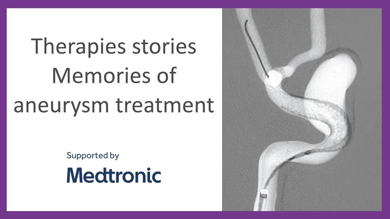 Therapies stories Memories of aneurysm treatment YouTube