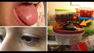 Deficiencia de k12 síntomas de vitamina