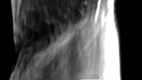 SEM study of fracture in cadmium single crystal