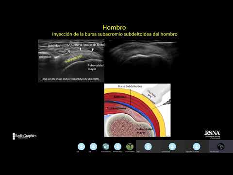 Vídeo: Ultrasonido: Propósito, Procedimiento Y Preparación