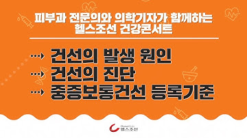 [건강똑똑 건선 서울편] 건선의 원인과 진단 및 치료법