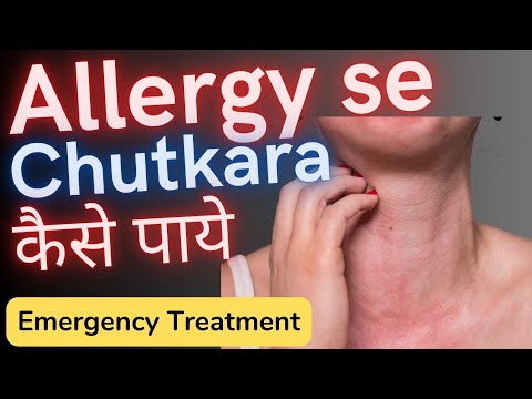 वीडियो: क्या मुझे एलर्जी की प्रतिक्रिया हुई?