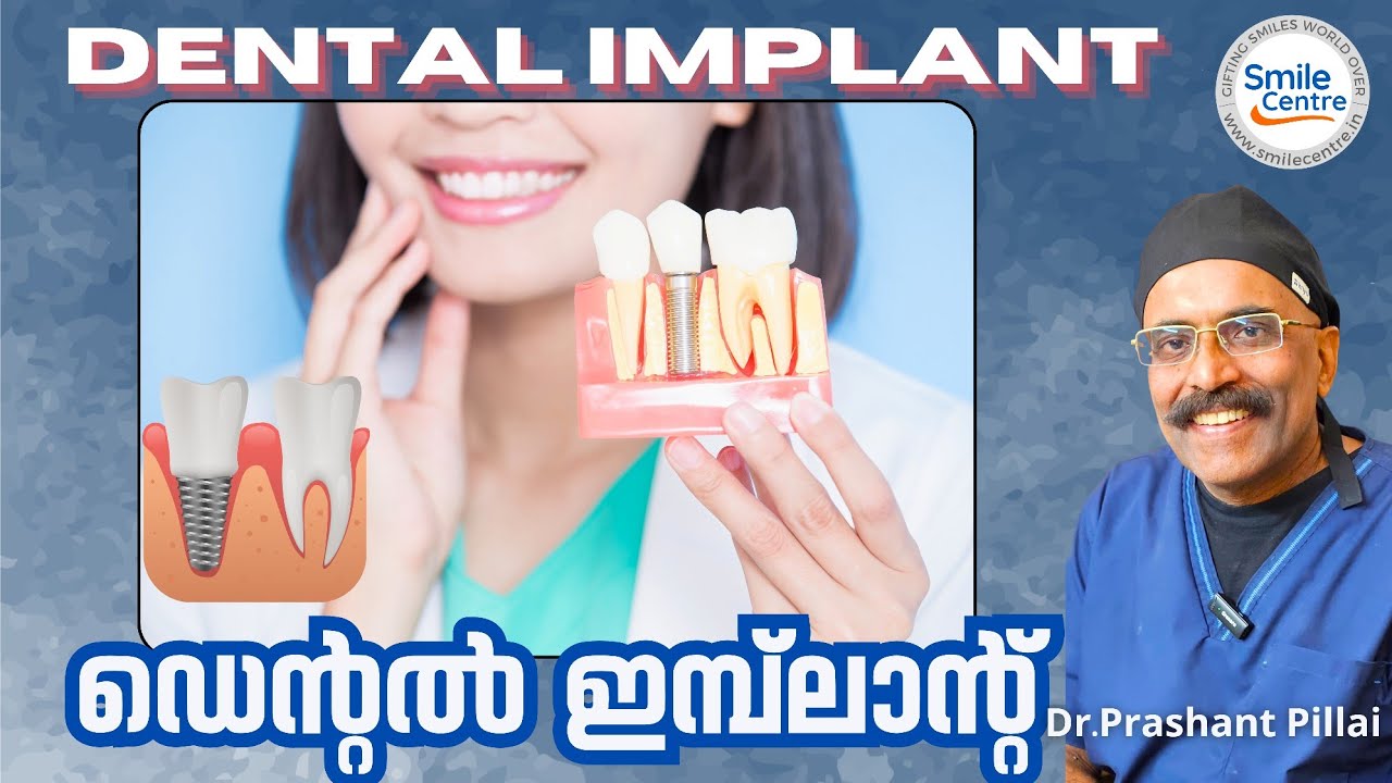 The Role of Dental Implants in Restoring Smile Function & Confidence A Life-Changing Solution