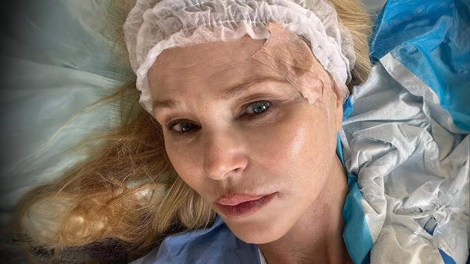 Christie Brinkley Reveals She Has Skin Cancer