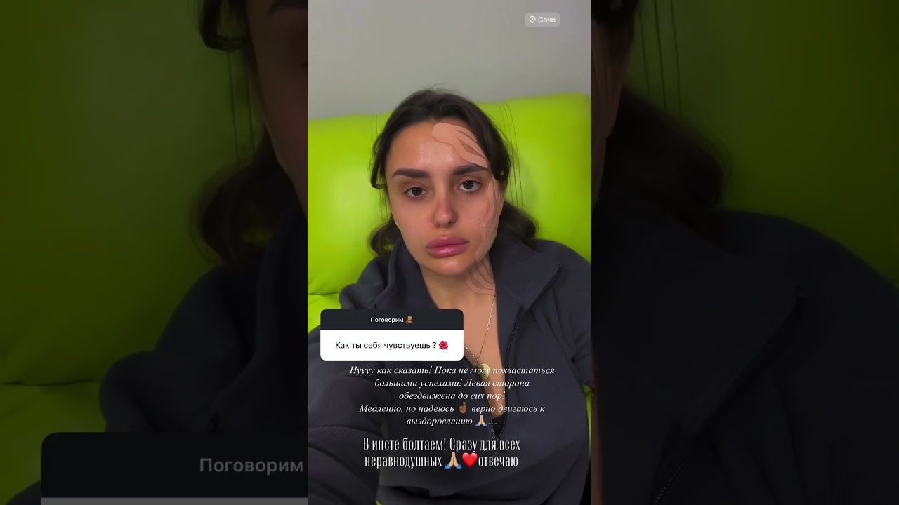 Паралич Белла! Реабилитация..🙏🏼 #параличбелла