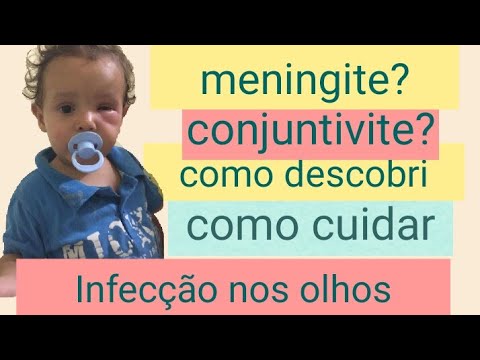 Vídeo: Se A Criança Tem Olhos Inchados