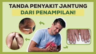 Kamu Bisa Tahu Tanda Penyakit Jantung Dari Penampilan! Penasaran Apa Saja? Yuk Simak Video Ini