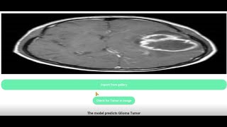 Brain tumor app simulation screenshot 2