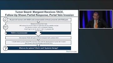 Optimal Management of HCC: Integrating Novel Therapeutic Approaches Across the Continuum of Care