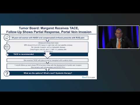 Optimal Management of HCC: Integrating Novel Therapeutic Approaches Across the Continuum of Care