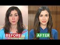 HOW I STOPPED MY HAIR LOSS: WHAT WORKED FOR ME